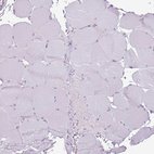 Immunohistochemical staining of human skeletal muscle shows no positivity in myocytes as expected.