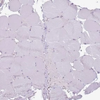 Immunohistochemical staining of human skeletal muscle shows no positivity in myocytes as expected.