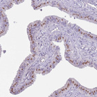 Immunohistochemical staining of human fallopian tube shows weak nuclear positivity in glandular cells.