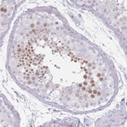 Immunohistochemical staining of human testis shows moderate nuclear positivity in cells in seminiferous ducts.