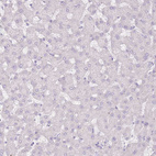 Anti-RFX2 Antibody