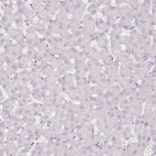 Immunohistochemical staining of human liver shows no positivity in hepatocytes as expected.