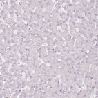 Immunohistochemical staining of human liver shows no positivity in hepatocytes as expected.