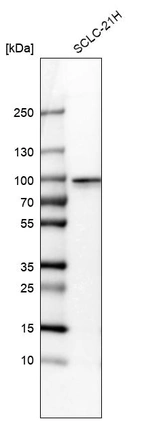 Western blot analysis in human cell line SCLC-21H.