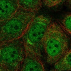 Immunofluorescent staining of human cell line MCF7 shows localization to nucleoplasm, cytosol & the Golgi apparatus.