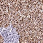 Anti-PCNX1 Antibody