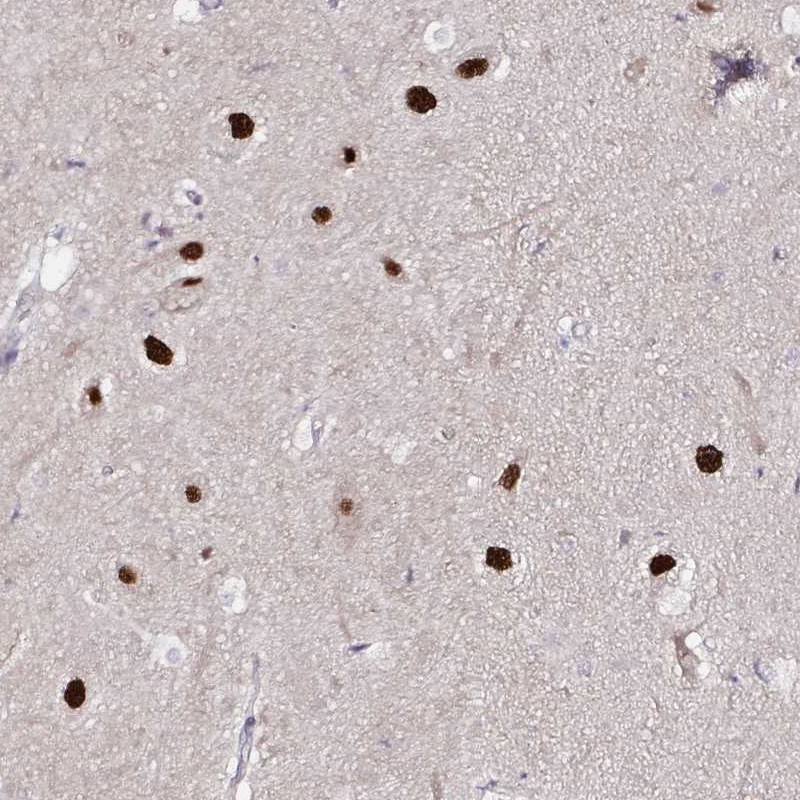 Anti-PSMD3 Antibody