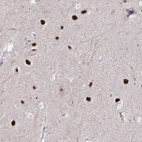 Anti-PSMD3 Antibody