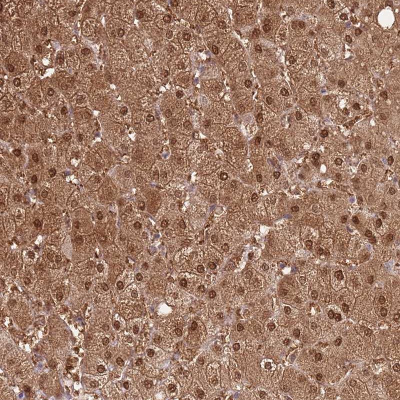 Anti-PLPPR2 Antibody
