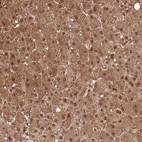 Anti-PLPPR2 Antibody