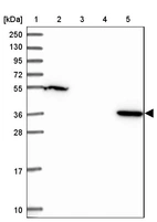 Lane 1: Marker [kDa] 250, 130, 95, 72, 55, 36, 28, 17, 10_br/_Lane 2: Human cell line RT-4_br/_Lane 3: Human cell line U-251MG sp_br/_Lane 4: Human plasma (IgG/HSA depleted)_br/_Lane 5: Human liver tissue