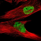 Immunofluorescent staining of human cell line U-251 MG shows localization to nucleoplasm.