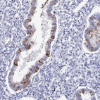 Anti-PDE4C Antibody