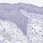 Anti-PDE4C Antibody