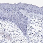 Immunohistochemical staining of human skin shows low expression as expected.