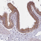 Anti-SRP54 Antibody