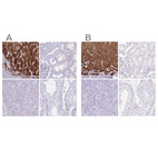 Immunohistochemical staining of human adrenal gland, kidney, pancreas and testis using Anti-CYP21A2 antibody HPA048979 (A) shows similar protein distribution across tissues to independent antibody HPA053371 (B).