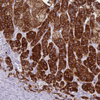 Immunohistochemical staining of human adrenal gland shows strong cytoplasmic positivity in glandular cells in adrenal cortex.