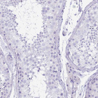 Immunohistochemical staining of human testis shows no positivity in cells in seminiferous ducts as expected.