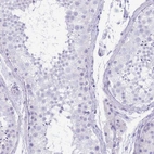 Immunohistochemical staining of human testis shows no positivity in cells in seminiferous ducts as expected.