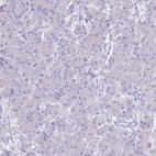 Immunohistochemical staining of human pancreas shows no positivity in exocrine glandular cells as expected.