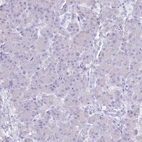 Immunohistochemical staining of human pancreas shows no positivity in exocrine glandular cells as expected.