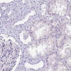 Immunohistochemical staining of human kidney shows no positivity in cells in tubules as expected.