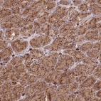 Anti-SGSM3 Antibody