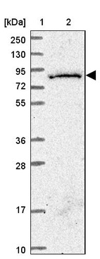 Anti-SGSM3 Antibody