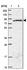 Anti-SGSM3 Antibody