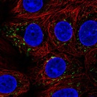 Immunofluorescent staining of human cell line MCF7 shows localization to the Golgi apparatus.