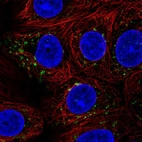 Immunofluorescent staining of human cell line MCF7 shows localization to the Golgi apparatus.