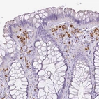 Immunohistochemical staining of human rectum shows strong cytoplasmic positivity in tissue macrophages.