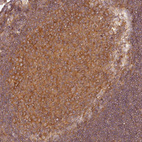 Immunohistochemical staining of human tonsil tissues shows moderate cytoplasmic positivity in germinal center cells.