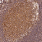 Immunohistochemical staining of human tonsil tissues shows moderate cytoplasmic positivity in germinal center cells.