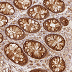 Immunohistochemical staining of human colon shows strong cytoplasmic positivity in glandular cells.