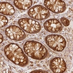 Immunohistochemical staining of human colon shows strong cytoplasmic positivity in glandular cells.