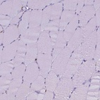 Immunohistochemical staining of human skeletal muscle shows no positivity as expected.
