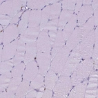 Immunohistochemical staining of human skeletal muscle shows no positivity as expected.