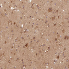 Immunohistochemical staining of human cerebral cortex shows moderate cytoplasmic positivity in neurons.