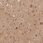 Immunohistochemical staining of human cerebral cortex shows moderate cytoplasmic positivity in neurons.