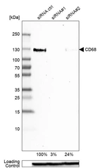 Western blot analysis in U-87MG ATCC cells transfected with control siRNA, target specific siRNA probe #1 and #2, using Anti-CD68 antibody. Remaining relative intensity is presented. Loading control: Anti-GAPDH.