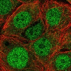 Immunofluorescent staining of human cell line MCF7 shows localization to nucleoplasm & cytosol.