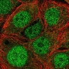 Immunofluorescent staining of human cell line MCF7 shows localization to nucleoplasm & cytosol.