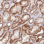 Anti-TIMM13 Antibody