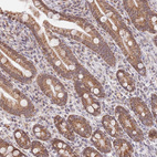 Anti-TIMM13 Antibody