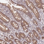 Immunohistochemical staining of human duodenum shows moderate granular cytoplasmic positivity in glandular cells.