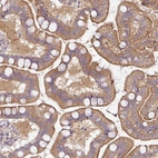 Anti-PLEKHJ1 Antibody