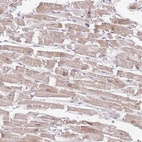 Immunohistochemical staining of human heart muscle shows moderate granular cytoplasmic positivity in cardiomyocytes.
