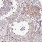 Immunohistochemical staining of human testis shows moderate cytoplasmic positivity in Leydig cells.